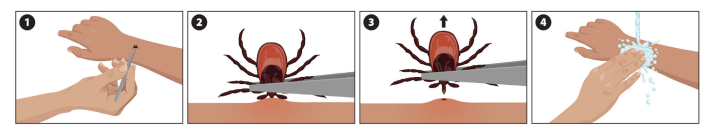 tick removal steps.png